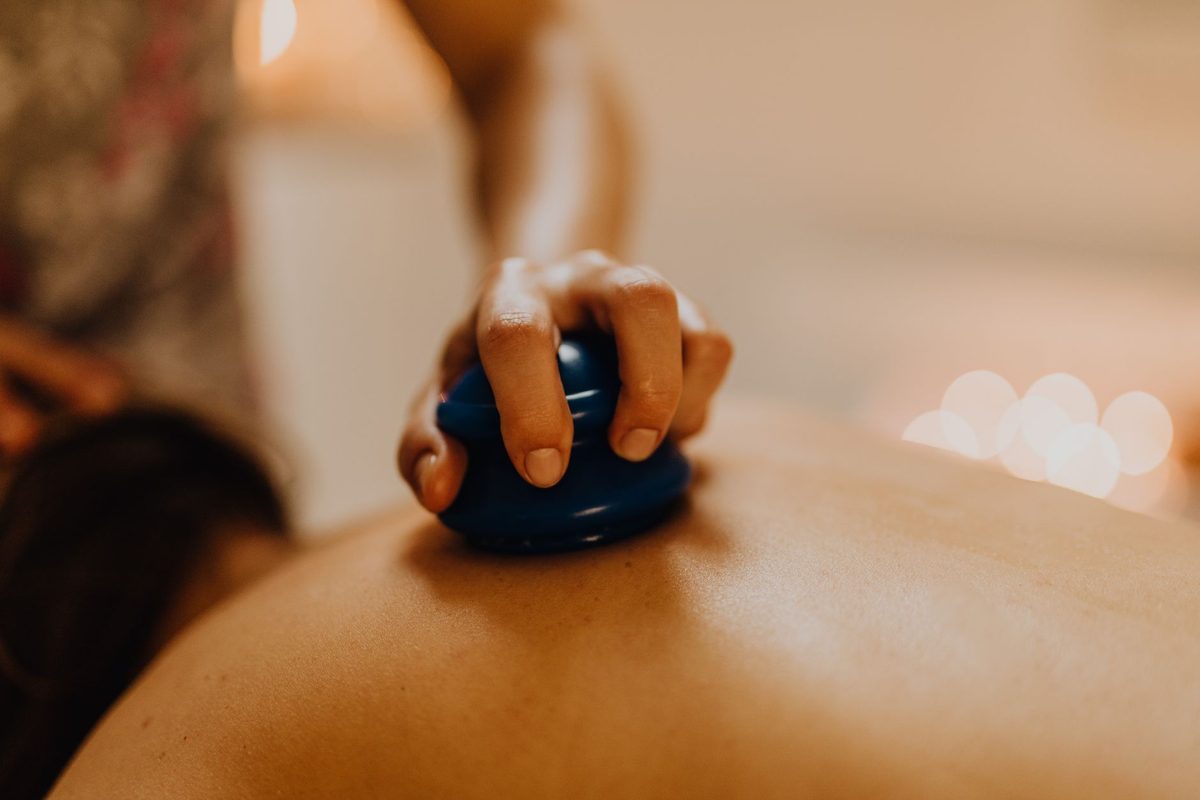 Cupping therapy on a patient's back